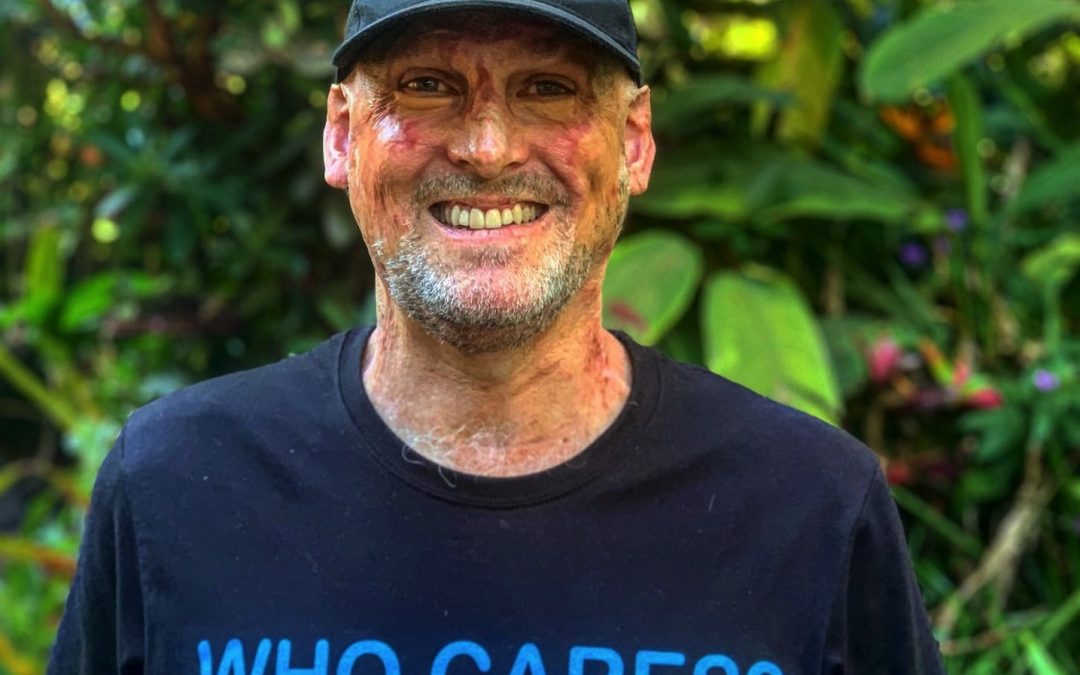 Celebrity Chef Matt Golinski Cares